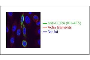 Spectral Confocal Microscopy of CHO cells using KH-4F5. (CCR4 抗体)