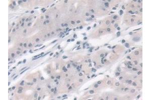 Immunohistochemistry (IHC) image for anti-VAMP (Vesicle-Associated Membrane Protein)-Associated Protein B and C (VAPB) (AA 1-132) antibody (ABIN7443908)