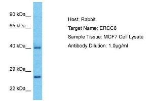 Western Blotting (WB) image for anti-Excision Repair Cross-Complementing Rodent Repair Deficiency, Complementation Group 8 (ERCC8) (C-Term) antibody (ABIN2777347)