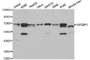 Western blot analysis of extracts of various cell lines, using IGF2BP1 antibody. (IGF2BP1 抗体  (C-Term))
