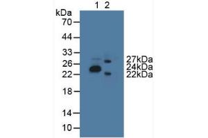 Western blot analysis of (1) Porcine Stomach Tissue and (2) Mouse Brain Tissue. (GLTP 抗体  (AA 2-209))