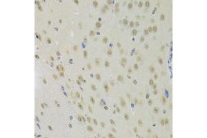 Immunohistochemistry of paraffin-embedded mouse brain using PRPF3 Antibody.