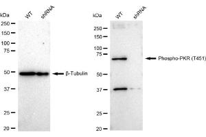 Western blotting analysis using Phospho-PKR (T451) antibody (ABIN7798509).