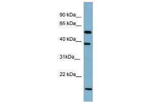 SLC10A1 antibody used at 1 ug/ml to detect target protein. (SLC10A1 抗体)