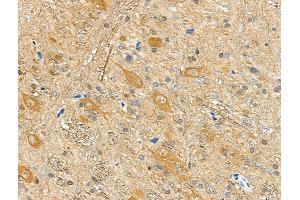 ABIN6256273 and ABIN6277785 at 1/100 staining Rat brain tissue by IHC-P.