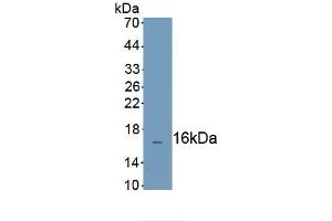 Detection of Recombinant CFHR3, Human using Polyclonal Antibody to Complement Factor H Related Protein 3 (CFHR3) (CFHR3 抗体  (AA 208-330))