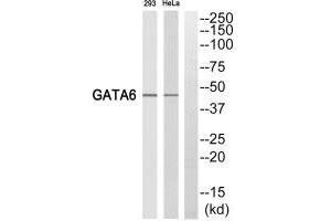 Western blot analysis of extracts from 293 cells and HeLa cells, using GATA6 antibody. (GATA6 抗体  (C-Term))