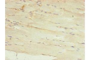 Immunohistochemistry of paraffin-embedded human skeletal muscle tissue using ABIN7142261 at dilution of 1:100 (MRPS22 抗体  (AA 1-360))