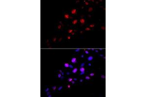 Immunofluorescence analysis of U2OS cell using RAD18 antibody. (RAD18 抗体)