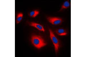 Immunofluorescent analysis of Caspase 6 p18 staining in NIH3T3 cells. (Caspase 6 p18 (Center) 抗体)