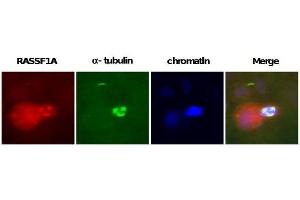 Image no. 2 for anti-Ras Association (RalGDS/AF-6) Domain Family Member 1 (RASSF1) antibody (ABIN165456) (RASSF1 抗体)