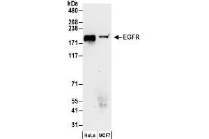 Western Blotting (WB) image for anti-Epidermal Growth Factor Receptor (EGFR) (AA 1100-1150) antibody (ABIN7454623)