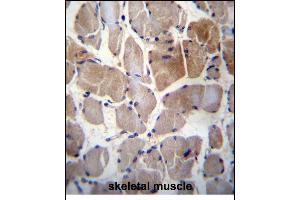 Immunohistochemistry (Paraffin-embedded Sections) (IHC (p)) image for anti-Ribosomal Protein S6 Kinase, 52kDa, Polypeptide 1 (RPS6KC1) (AA 20-47), (N-Term) antibody (ABIN656394)
