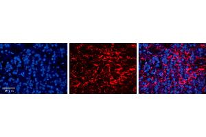 Rabbit Anti-LAPTM4B Antibody     Formalin Fixed Paraffin Embedded Tissue: Human Pineal Tissue  Observed Staining: Membrane and cytoplasmic in processes of pinealocytes and intersticial cells  Primary Antibody Concentration: 1:100  Other Working Concentrations: 1/600  Secondary Antibody: Donkey anti-Rabbit-Cy3  Secondary Antibody Concentration: 1:200  Magnification: 20X  Exposure Time: 0. (LAPTM4B 抗体  (Middle Region))