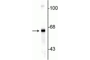 Western blot of rat cortex lysate showing specific immunolabeling of the ~ 66 kDa alpha internexin protein. (INA 抗体)
