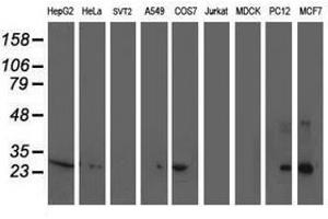 Image no. 1 for anti-Sirtuin 5 (SIRT5) antibody (ABIN1500928) (SIRT5 抗体)