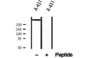 Western blot analysis of extracts from A431, using DST Antibody. (Dystonin 抗体  (C-Term))