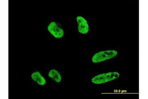 Immunofluorescence of monoclonal antibody to RNF151 on HeLa cell. (RNF151 抗体  (AA 68-173))
