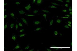 Immunofluorescence of monoclonal antibody to STC1 on HeLa cell. (Stanniocalcin 1 抗体  (AA 141-247))