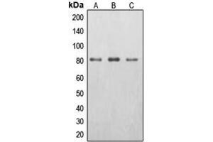 Western blot analysis of EPS8L2 expression in HepG2 (A), HeLa (B), A431 (C) whole cell lysates. (EPS8-Like 2 抗体  (N-Term))