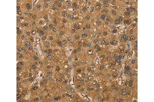 Immunohistochemistry (IHC) image for anti-SET Domain Containing 2 (SETD2) antibody (ABIN2429290) (SETD2 抗体)