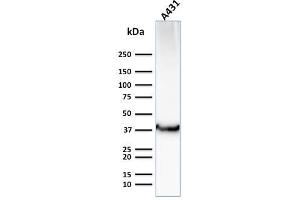 Western Blot Analysis of Human A431 cell lysate using GLUT-1 Mouse Monoclonal Antibody (GLUT1/2476). (GLUT1 抗体  (AA 203-305))