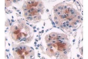 Immunohistochemistry (IHC) image for anti-Proteasome (Prosome, Macropain) 26S Subunit, Non-ATPase, 2 (PSMD2) (AA 645-872) antibody (ABIN7439738)