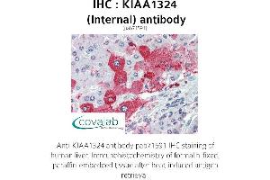 Image no. 2 for anti-Endosome/Lysosome-associated Apoptosis and Autophagy Regulator 1 (ELAPOR1) (Internal Region) antibody (ABIN1736215) (ELAPOR1 抗体  (Internal Region))