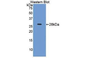 Western blot analysis of recombinant Mouse ICAM4.