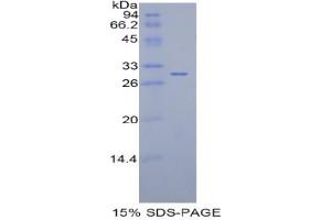 SDS-PAGE analysis of Rat IDH1 Protein. (IDH1 Protein (Soluble))