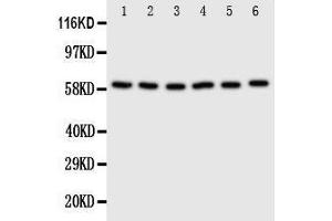 Anti-SCLY antibody, Western blotting Lane 1: U87 Cell Lysate Lane 2: HELA Cell Lysate Lane 3: 293T Cell Lysate Lane 4: MCF-7 Cell Lysate Lane 5: COLO320 Cell Lysate Lane 6:  Cell Lysate (SCLY 抗体  (C-Term))