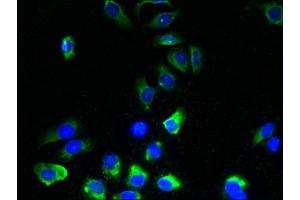 Immunofluorescent analysis of A549 cells using ABIN7173167 at dilution of 1:100 and Alexa Fluor 488-congugated AffiniPure Goat Anti-Rabbit IgG(H+L) (TMEM243 抗体  (AA 1-31))