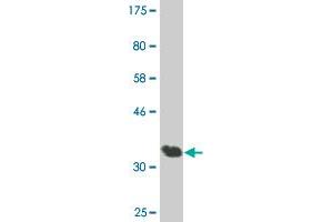 Western Blot detection against Immunogen (36. (AATK 抗体  (AA 161-260))