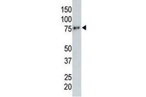 Anti-HA tag antibody testing a tagged recombinant protein. (HA-Tag 抗体)