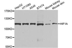 Western blot analysis of extracts of various cell lines, using HIF1A antibody. (HIF1A 抗体)