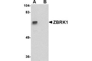 Western blot analysis of ZBRK1 in A-20 lysate with this product at 1 μg/ml in (A) the absence and (B) the presence of blocking peptide. (ZNF350 抗体  (C-Term))