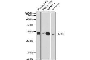Western blot analysis of extracts of various cell lines, using MRRF antibody (ABIN7268589) at 1:1000 dilution. (MRRF 抗体)