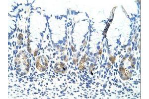 Image no. 1 for anti-Adenosine Deaminase, tRNA-Specific 1 (ADAT1) (C-Term) antibody (ABIN6736282) (ADAT1 抗体  (C-Term))