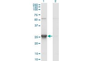 Western Blot analysis of TK1 expression in transfected 293T cell line by TK1 monoclonal antibody (M12), clone 3A8. (TK1 抗体  (AA 1-234))