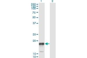 Western Blot analysis of PSCA expression in transfected 293T cell line by PSCA monoclonal antibody (M02), clone 1E1. (PSCA 抗体  (AA 23-95))