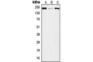 Western blot analysis of Plexin A2 expression in A549 (A), Raw264. (Plexin A2 抗体  (Center))