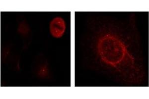 Image no. 3 for anti-Mitogen-Activated Protein Kinase 1/3 (MAPK1/3) (pThr187), (pTyr204) antibody (ABIN197000) (ERK1/2 抗体  (pThr187, pTyr204))