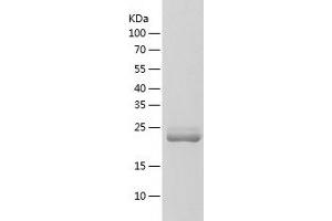 Western Blotting (WB) image for Interleukin-27 subunit beta (IL-27b) (AA 23-228) protein (His-IF2DI Tag) (ABIN7122810) (EBI3 Protein (AA 23-228) (His-IF2DI Tag))