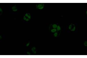 Immunofluorescence staining of MCF7 Cells with ABIN7127801 at 1:50, counter-stained with DAPI. (Recombinant STAG2 抗体)