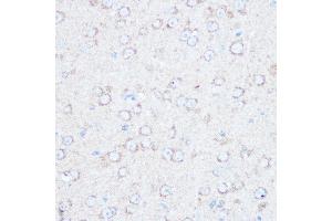Immunohistochemistry of paraffin-embedded mouse brain using TSC2 Rabbit pAb (ABIN1683176, ABIN5663676 and ABIN7101314) at dilution of 1:100 (40x lens). (Tuberin 抗体)