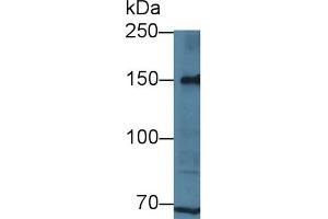 Detection of LRP8 in Human Hela cell lysate using Polyclonal Antibody to Low Density Lipoprotein Receptor Related Protein 8 (LRP8) (LRP8 抗体  (AA 696-941))