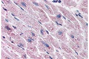 Immunohistochemistry (Formalin/PFA-fixed paraffin-embedded sections) of human heart tissue with EDNRA polyclonal antibody . (Endothelin-1 Receptor 抗体  (C-Term))