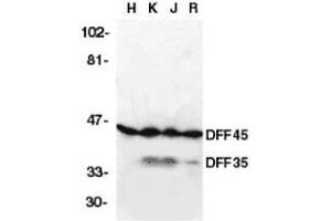Western blot analysis of DFF45 in HeLa (H), K562 (K) Jurkat (J), and Raji (R) cell lysates with DFF45 antibody at 2μg/ml. (DFFA 抗体  (AA 2-21))