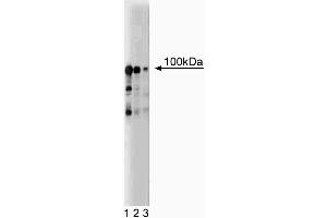Western blot analysis of UBE3A on a EB-1 cell lysate (Human B lymphoblast, Burkitt's lymphoma, ATCC HTB-60). (ube3a 抗体  (AA 501-712))