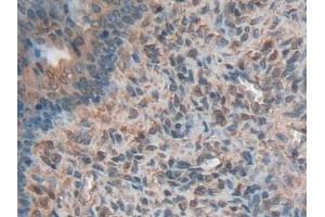 Detection of HMWK in Rat Ovary Tissue using Polyclonal Antibody to High Molecular Weight Kininogen (HMWK) (Kininogen (HMW) 抗体  (AA 214-475))